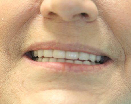 A close up of the teeth of a person